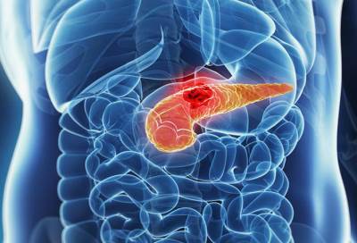 العقاقير المخفضة للضغط تسبب الإصابة بسرطان البنكرياس للمرأة