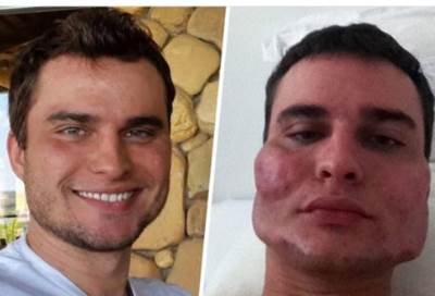 دكتور تجميل يحول الأشخاص إلى وحوش بدلا من تجميلهم