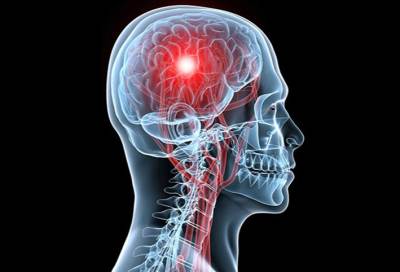 القليل من الرياضة قد يحمى من السكتة الدماغية