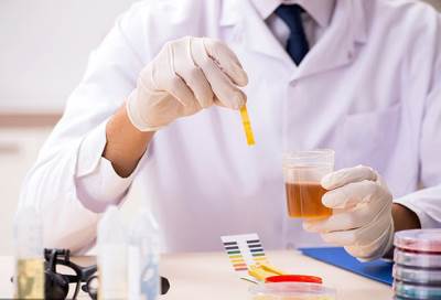 من المنزل تحليل بول يكشف وجود سرطان البروستاتا من عدمه ويضع نهاية للفحص الشرجي المزعج