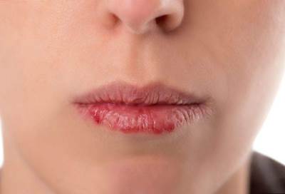 أسباب تؤدى إلى جفاف الفم .. تعرفي عليها