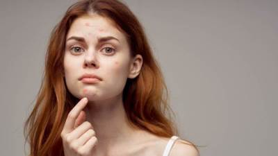 إليك هذه النصائح الفعالة للتخلص من بثور الذقن   