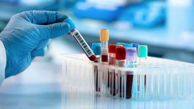 7 تحاليل تكشف عن الإصابة بـ فيروس كورونا