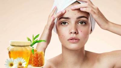 كيفية التخلص من البثور العمياء