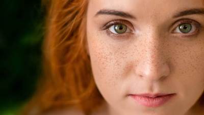 الليمون والصبار لعلاج النمش نهائيا .. تعرف على الطريقة!