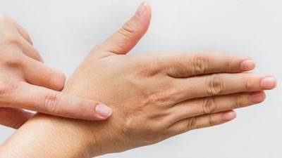 وصفات طبيعية للتخلص من أثار الجروح القديمة