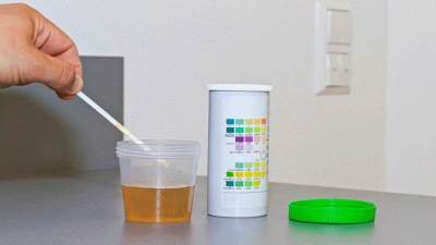 انتبه .. تغير لون البول للرمادى يشير إلى أمراض خطيرة