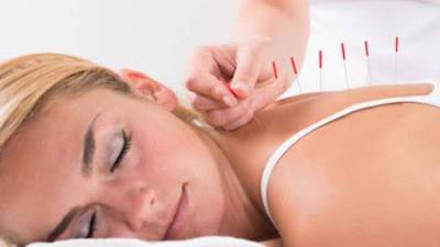 هل علاج الوخز بالإبر مفيد في علاج مشاكل العظام؟