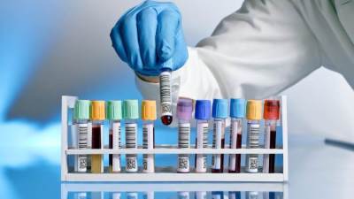 ما التحاليل الضرورية للكشف عن الإصابة بالإيدز؟