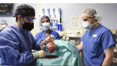 لأول مرة فى التاريخ .. زراعة قلب خنزير لمريض بشرى فى أمريكا 