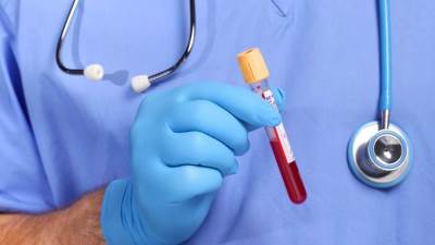 اختبار دم بسيط يتنبأ بالإصابة بالنوبة القلبية قبل 3 سنوات من حدوثها