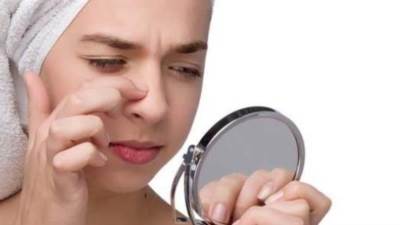 أزيلي الرؤوس السوداء بكل سهولة خلال لحظات