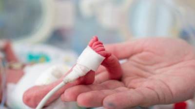 الأطفال الخدج.. ما المضاعفات التي يمكن أن تحدث لهم؟