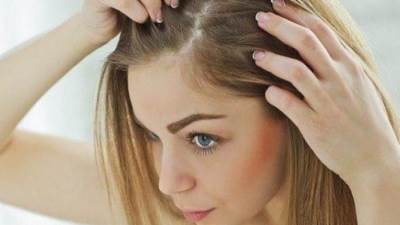 وصفات منزلية فعالة في القضاء نهائياً على قشرة الشعر
